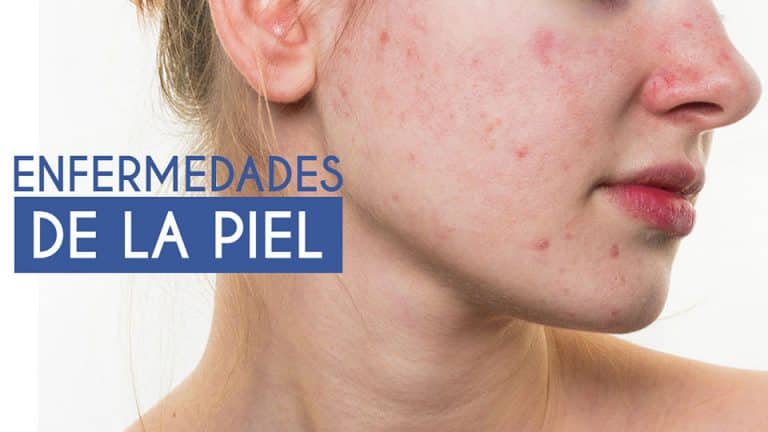 25 Enfermedades de la piel más comunes Causas y Síntomas