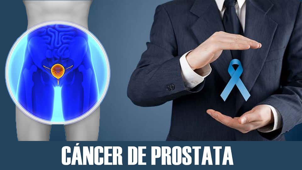 Cáncer de Prostata