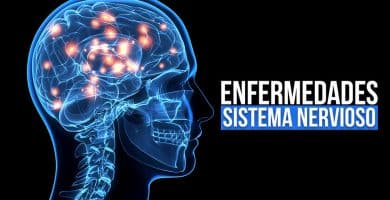 Enfermedades sistema nervioso central y periférico